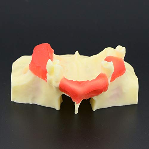Diş Sinüs Kaldırma Uygulama Modeli Çalışma Öğretim Diş Modeli M2013